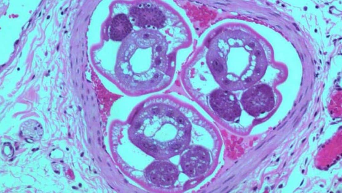 Angiostrongylus - The Two Types Explained - SCALAR LIGHT